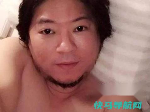该怎么减缓衰老